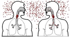 tratamento de tuberculose