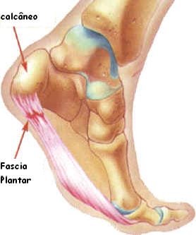 Localização da fascia plantar e o calcâneo. 