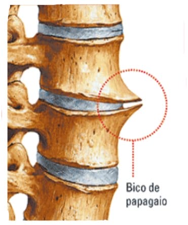 Bico de Papagaio