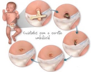 O cordão umbilical é uma área sensível dos recém nascidos que precisa ser cuidada.