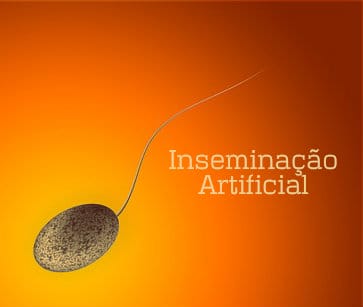 A inseminação é recomendada a todos casais que desejam ter filhos e não obtiveram sucesso pelo modo natural.