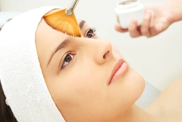 O peeling é um procedimento totalmente eficaz contra as marcas de acne