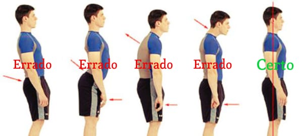 Tipos de postura.